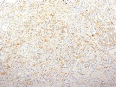Immunohistochemistry (Formalin/PFA-fixed paraffin-embedded sections) - Anti-Fibronectin antibody [TV-1] - BSA and Azide free (AB212373)