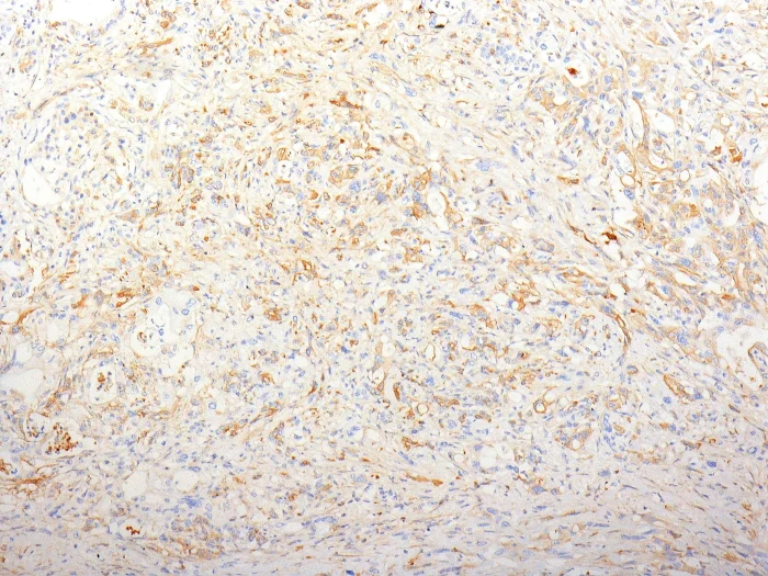 Immunohistochemistry (Formalin/PFA-fixed paraffin-embedded sections) - Anti-Fibronectin antibody [TV.1] (AB194395)