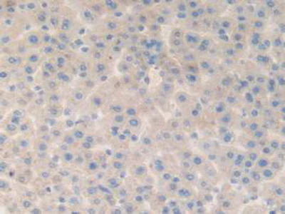 Immunohistochemistry (Formalin/PFA-fixed paraffin-embedded sections) - Anti-Fibulin 1 antibody (AB230994)
