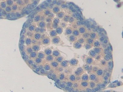 Immunohistochemistry (Formalin/PFA-fixed paraffin-embedded sections) - Anti-Fibulin 1 antibody (AB230994)