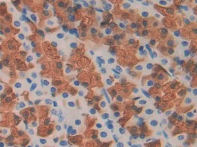 Immunohistochemistry (Formalin/PFA-fixed paraffin-embedded sections) - Anti-Fibulin 1 antibody (AB230994)