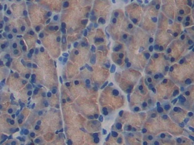 Immunohistochemistry (Formalin/PFA-fixed paraffin-embedded sections) - Anti-Fibulin 1 antibody (AB230994)