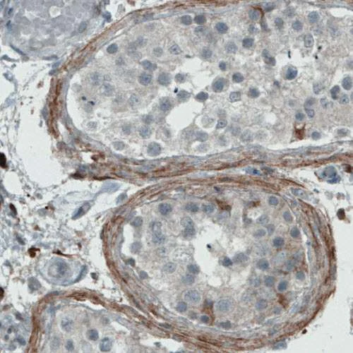 Immunohistochemistry - Anti-Fibulin 1 antibody [CL0337] (AB211536)