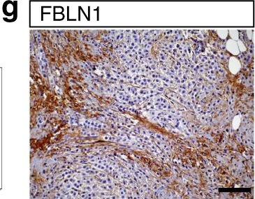 Immunohistochemistry - Anti-Fibulin 1 antibody [CL0337] (AB211536)