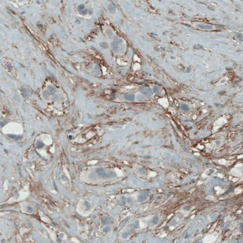 Immunohistochemistry - Anti-Fibulin 1 antibody [CL0337] (AB211536)