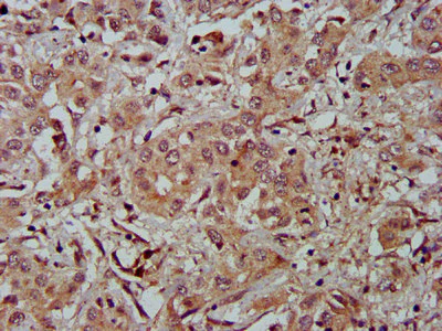 Immunohistochemistry (Formalin/PFA-fixed paraffin-embedded sections) - Anti-Fibulin 2 antibody (AB234993)