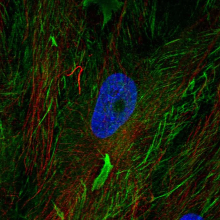 Immunocytochemistry/ Immunofluorescence - Anti-Fibulin 2 antibody (AB251662)