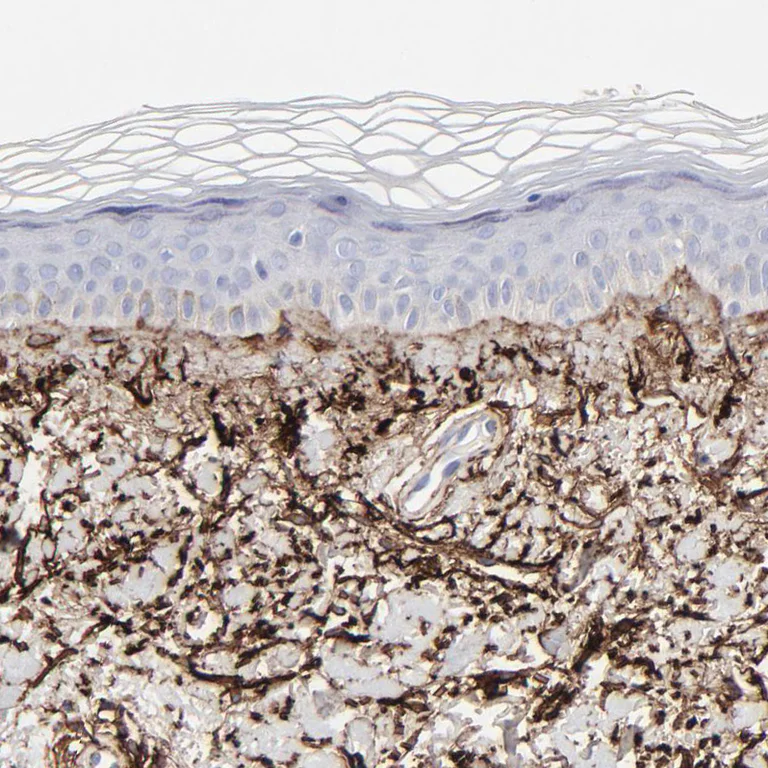Immunohistochemistry (Formalin/PFA-fixed paraffin-embedded sections) - Anti-Fibulin 2 antibody (AB251662)