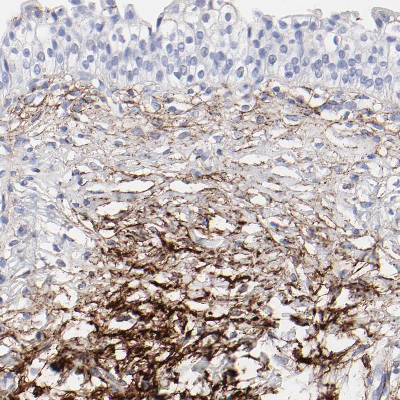 Immunohistochemistry (Formalin/PFA-fixed paraffin-embedded sections) - Anti-Fibulin 2 antibody (AB251662)