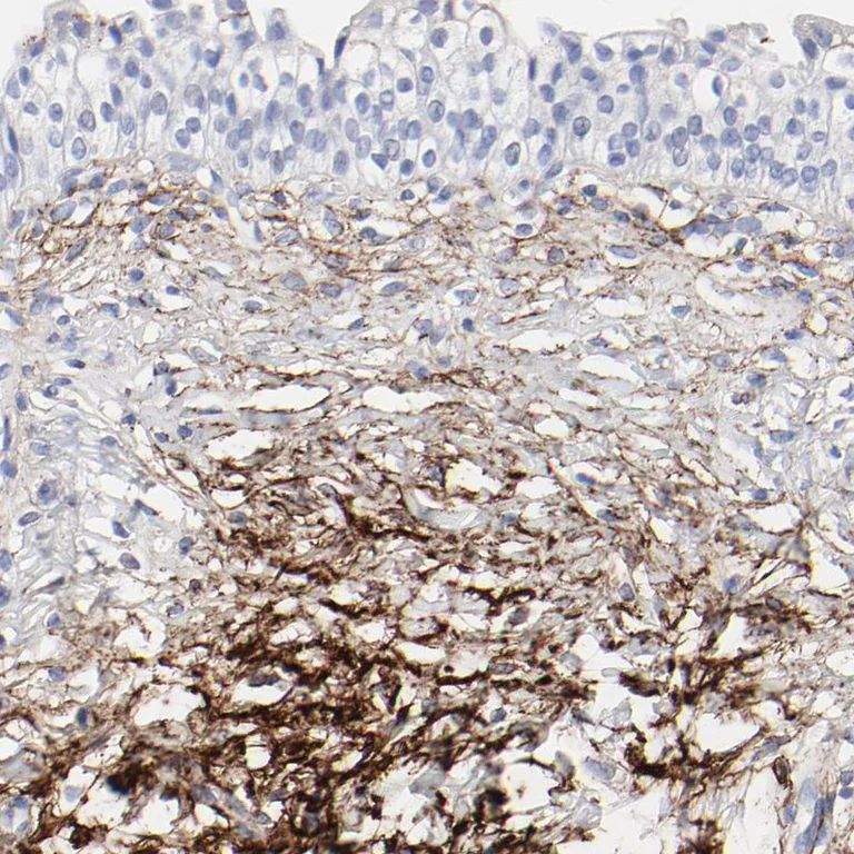 Immunohistochemistry (Formalin/PFA-fixed paraffin-embedded sections) - Anti-Fibulin 2 antibody (AB251662)