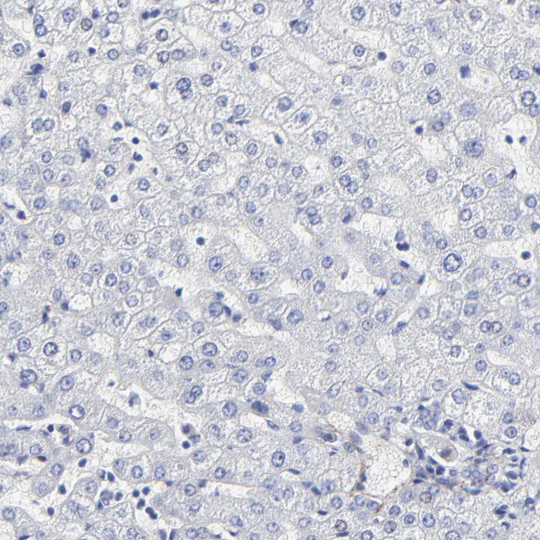 Immunohistochemistry (Formalin/PFA-fixed paraffin-embedded sections) - Anti-Fibulin 2 antibody (AB251662)