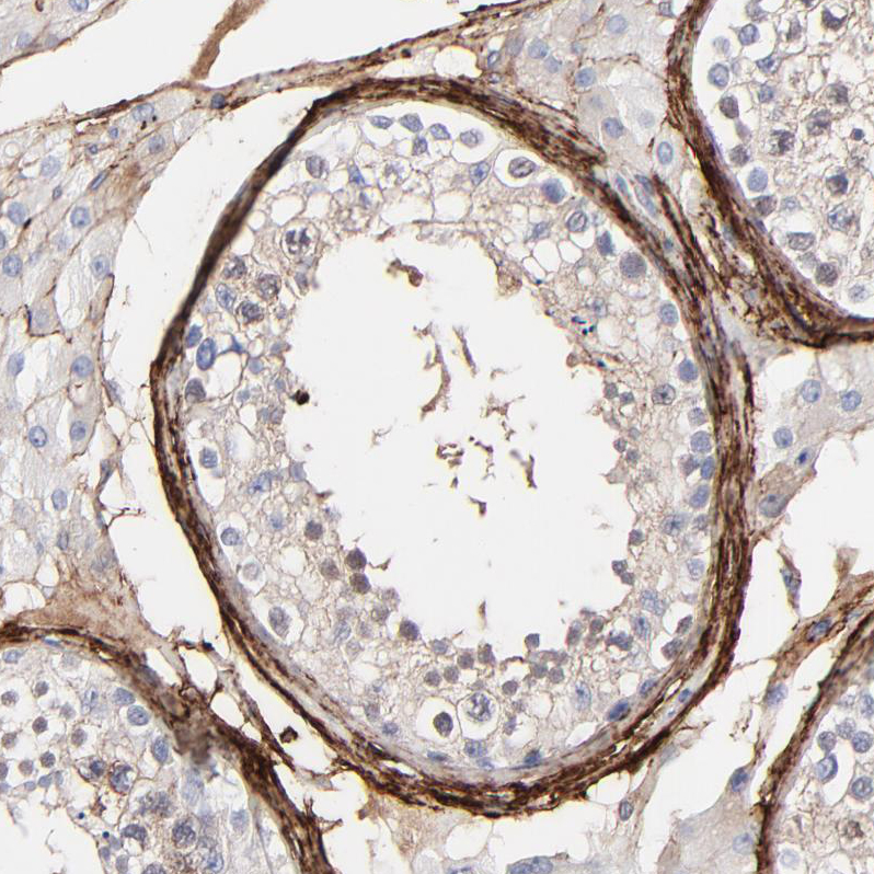 Immunohistochemistry (Formalin/PFA-fixed paraffin-embedded sections) - Anti-Fibulin 2 antibody (AB251662)