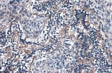 Immunohistochemistry (Formalin/PFA-fixed paraffin-embedded sections) - Anti-Fibulin 2 antibody (AB96138)