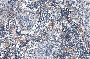 Immunohistochemistry (Formalin/PFA-fixed paraffin-embedded sections) - Anti-Fibulin 2 antibody (AB96138)