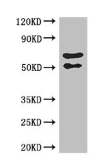 Western blot - Anti-Fibulin-4 antibody (AB222846), expandable thumbnail