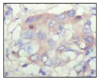 Immunohistochemistry (Formalin/PFA-fixed paraffin-embedded sections) - Anti-Fibulin 5 antibody [1G6A4] (AB66339)