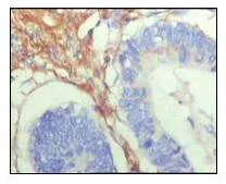 Immunohistochemistry (Formalin/PFA-fixed paraffin-embedded sections) - Anti-Fibulin 5 antibody [1G6A4] (AB66339)