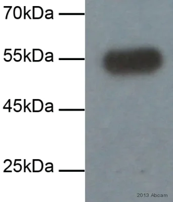 Western blot - Anti-Fibulin 5 antibody [1G6A4] (AB66339)