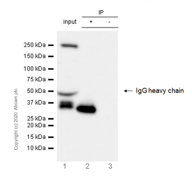 Immunoprecipitation - Anti-Ficolin 2 antibody [EPR23146-225] - BSA and Azide free (AB270404)