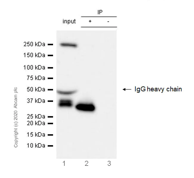 Immunoprecipitation - Anti-Ficolin 2 antibody [EPR23146-225] - BSA and Azide free (AB270404)