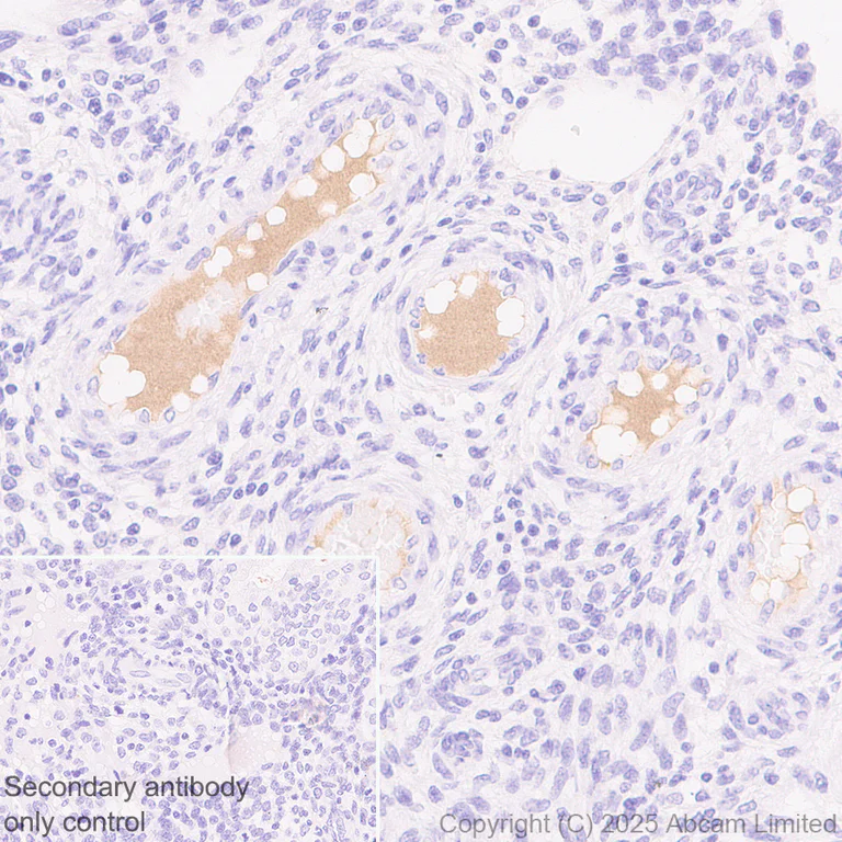 Immunohistochemistry (Formalin/PFA-fixed paraffin-embedded sections) - Anti-Ficolin-3 antibody [EPR30745-69] - BSA and Azide free (AB324687)
