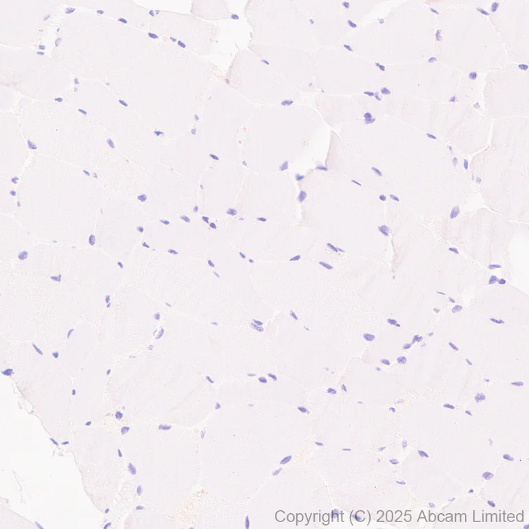 Immunohistochemistry (Formalin/PFA-fixed paraffin-embedded sections) - Anti-Ficolin-3 antibody [EPR30745-69] - BSA and Azide free (AB324687)
