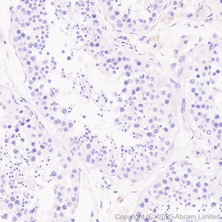 Immunohistochemistry (Formalin/PFA-fixed paraffin-embedded sections) - Anti-Ficolin-3 antibody [EPR30745-69] - BSA and Azide free (AB324687)
