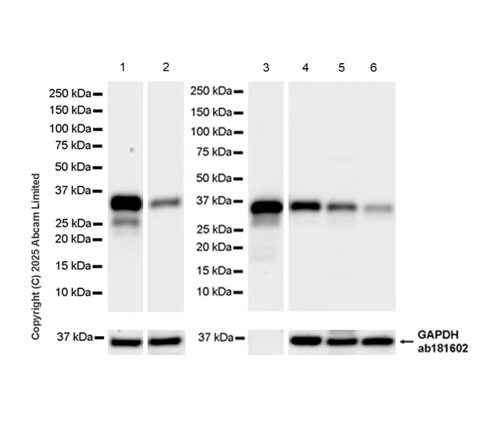 Western blot - Anti-Ficolin-3 antibody [EPR30745-69] - BSA and Azide free (AB324687)