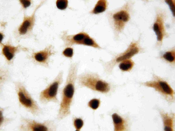 Immunocytochemistry/ Immunofluorescence - Anti-FIF antibody (AB65836)