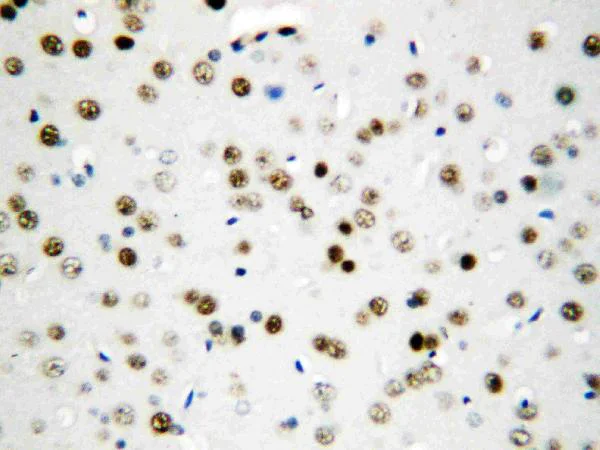 Immunohistochemistry (Formalin/PFA-fixed paraffin-embedded sections) - Anti-FIF antibody (AB65836)