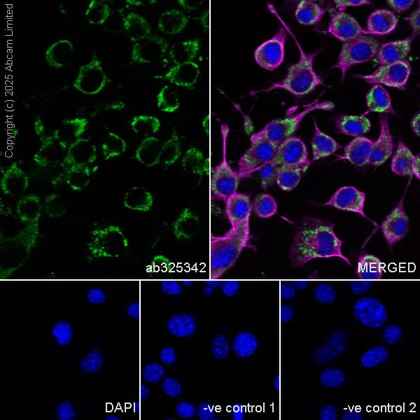 Immunocytochemistry/ Immunofluorescence - Anti-FIG4 antibody [EPR29554-575] (AB325342)
