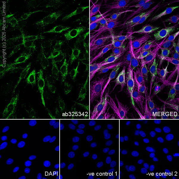 Immunocytochemistry/ Immunofluorescence - Anti-FIG4 antibody [EPR29554-575] (AB325342)