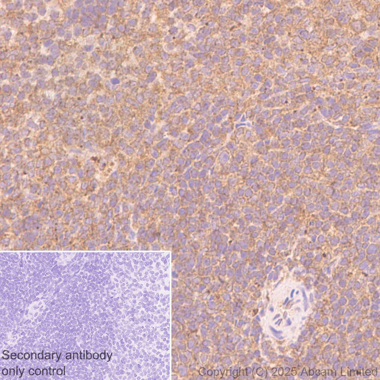 Immunohistochemistry (Formalin/PFA-fixed paraffin-embedded sections) - Anti-FIG4 antibody [EPR29554-575] (AB325342)