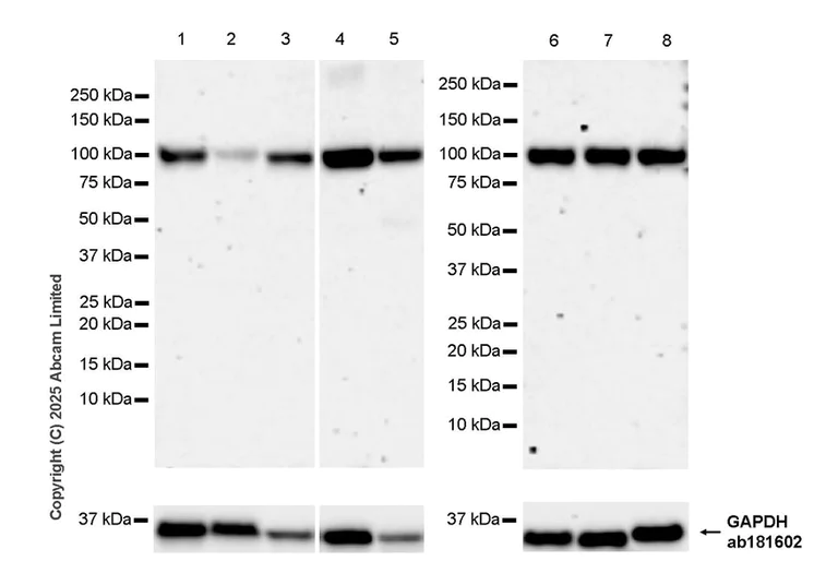 Western blot - Anti-FIG4 antibody [EPR29554-575] (AB325342)
