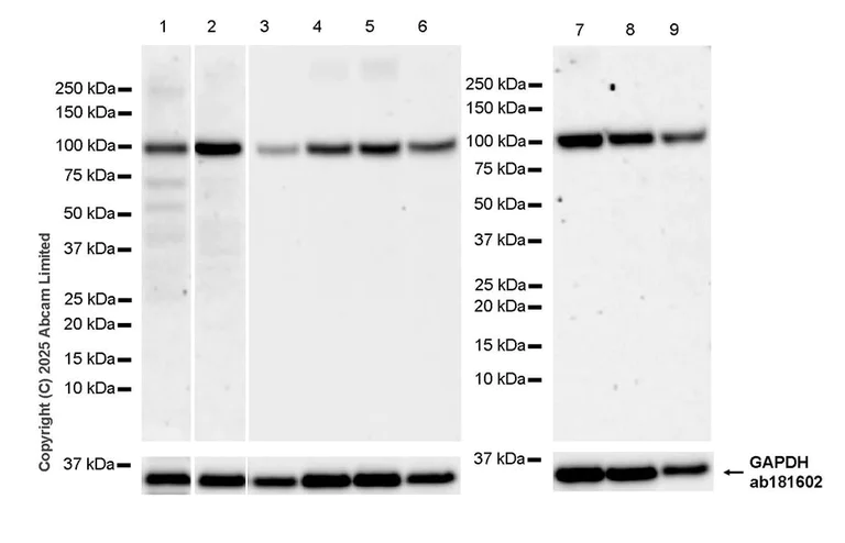 Western blot - Anti-FIG4 antibody [EPR29554-575] (AB325342)