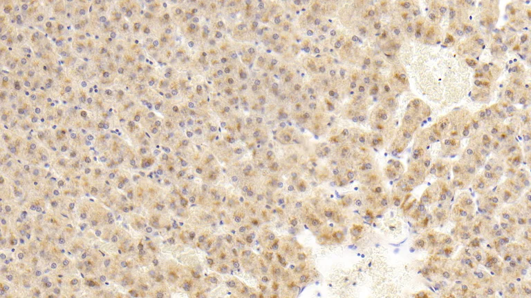 Immunohistochemistry (Formalin/PFA-fixed paraffin-embedded sections) - Anti-FIGN/Fidgetin antibody (AB232756)