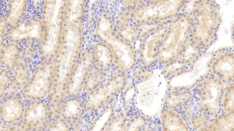 Immunohistochemistry (Formalin/PFA-fixed paraffin-embedded sections) - Anti-FIGN/Fidgetin antibody (AB232756)