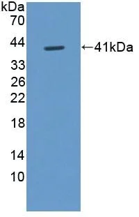 Western blot - Anti-FIGN/Fidgetin antibody (AB232756)