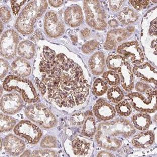 Immunohistochemistry (Formalin/PFA-fixed paraffin-embedded sections) - Anti-FIGNL1 antibody (AB185674)