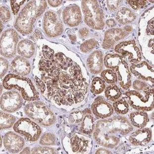 Immunohistochemistry (Formalin/PFA-fixed paraffin-embedded sections) - Anti-FIGNL1 antibody (AB185674)