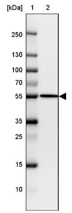 Western blot - Anti-FIGNL1 antibody (AB185674)