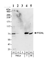 Western blot - Anti-FIGNL1 antibody (AB70841)