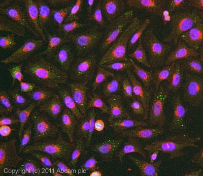 Immunocytochemistry/ Immunofluorescence - Anti-Filaggrin antibody (AB81468)