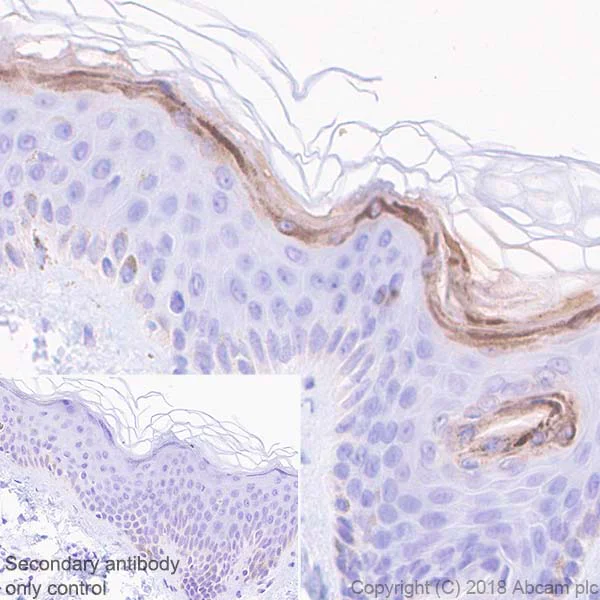Immunohistochemistry (Formalin/PFA-fixed paraffin-embedded sections) - Anti-Filaggrin antibody [EPR21892] (AB221155)