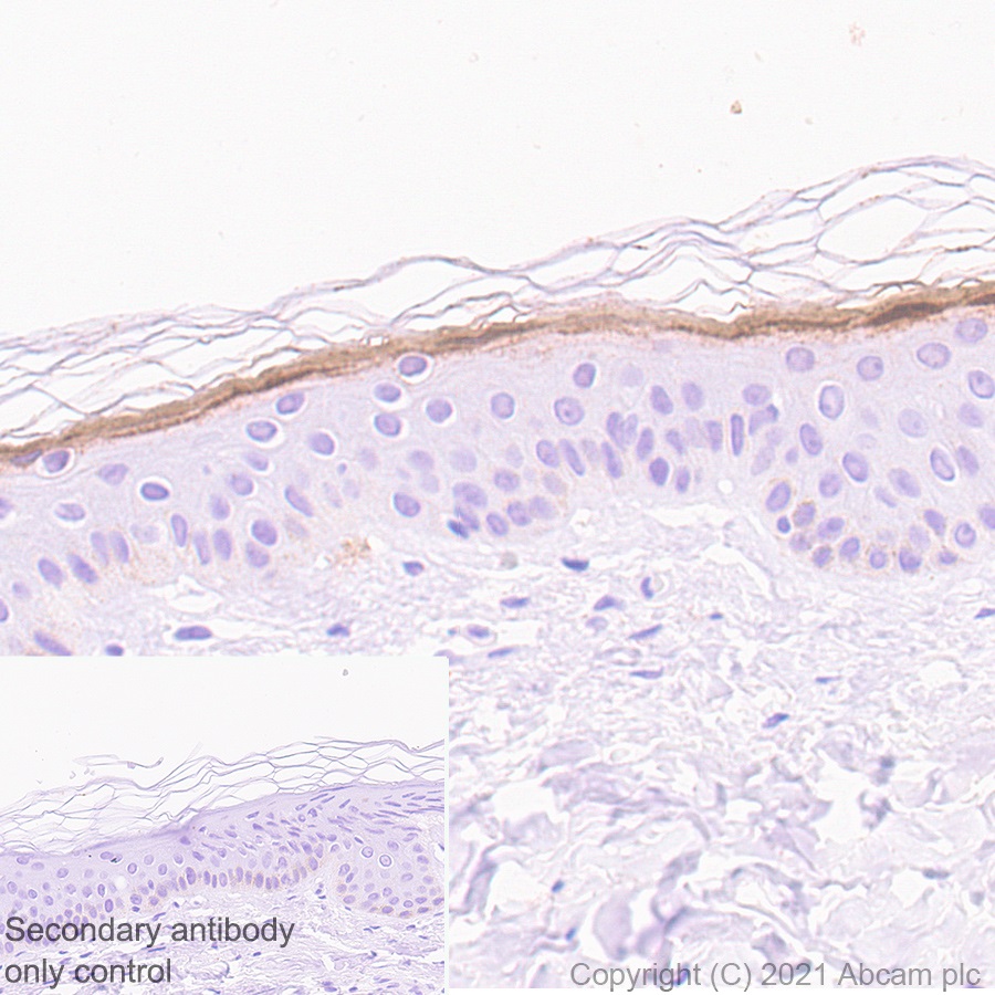 Immunohistochemistry (Formalin/PFA-fixed paraffin-embedded sections) - Anti-Filaggrin antibody [EPR21892] (AB221155)