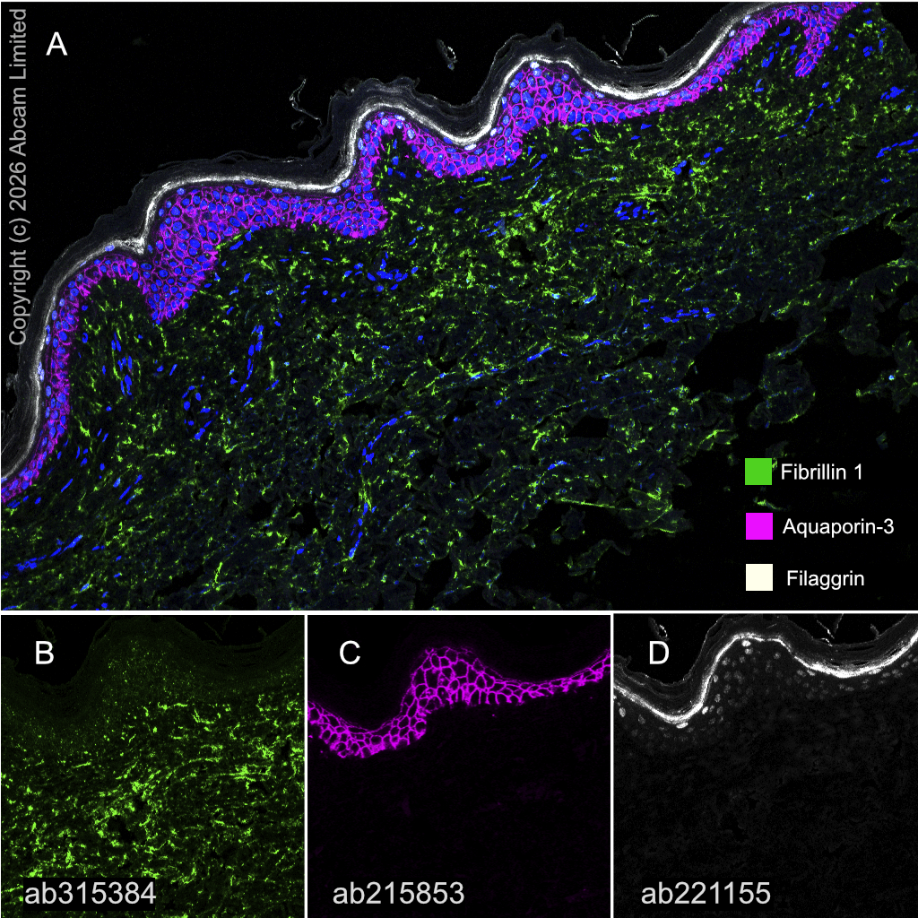 Multiplex immunohistochemistry - Anti-Filaggrin antibody [EPR21892] (AB221155)