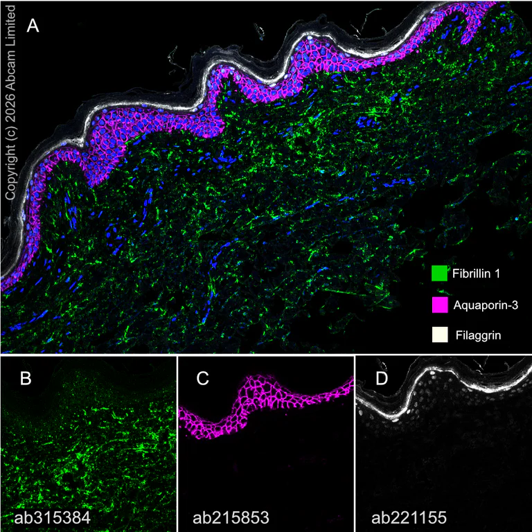 Multiplex immunohistochemistry - Anti-Filaggrin antibody [EPR21892] (AB221155)