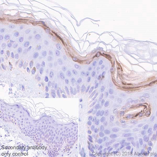 Immunohistochemistry (Formalin/PFA-fixed paraffin-embedded sections) - Anti-Filaggrin antibody [EPR21892] - BSA and Azide free (AB231821)