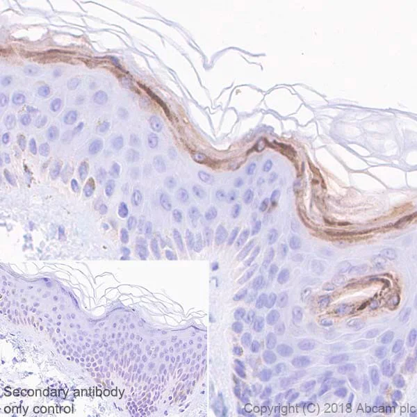 Immunohistochemistry (Formalin/PFA-fixed paraffin-embedded sections) - Anti-Filaggrin antibody [EPR21892] - BSA and Azide free (AB231821)
