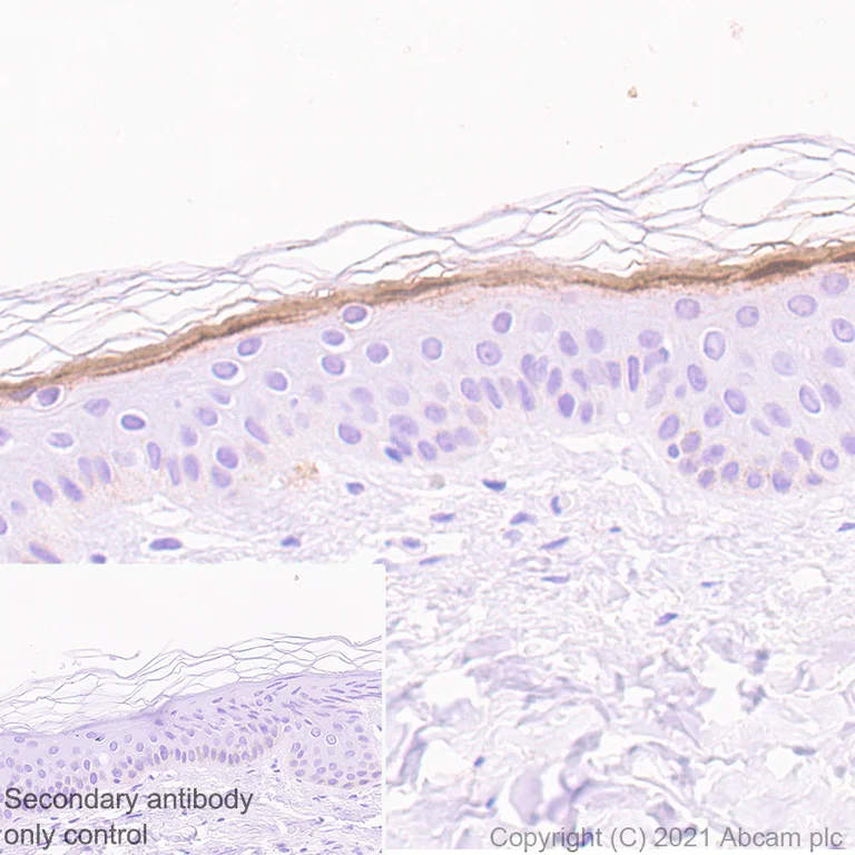 Immunohistochemistry (Formalin/PFA-fixed paraffin-embedded sections) - Anti-Filaggrin antibody [EPR21892] - BSA and Azide free (AB231821)